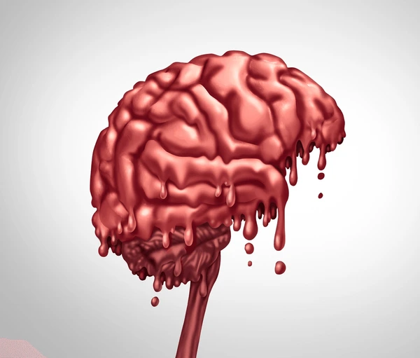 Brain Rot- New Problems, New Vocab!